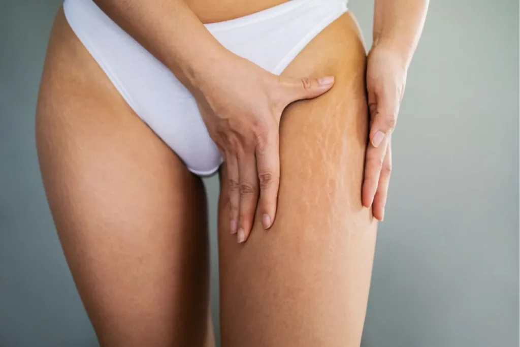 Linstitut By Flo Institut De Beaute A Menton Minceur 5